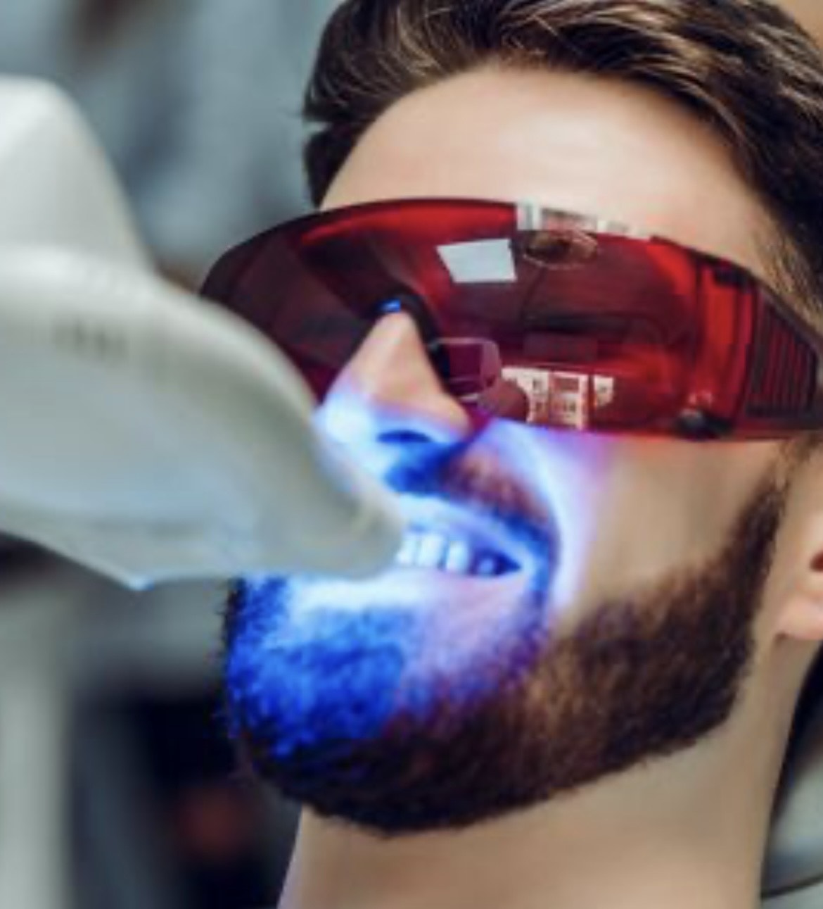 Professional Teeth Whitening