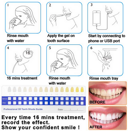 Custom Bleaching Trays/ Professional Grade Tooth Whitening Gel. Convenient At-Home Solution