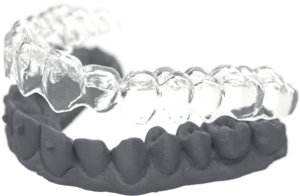 Retainer- for teeth retention (Upper & Lower)